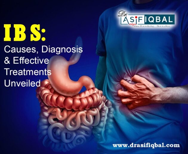 Irritable Bowel Syndrome (IBS): Causes & Treatment
