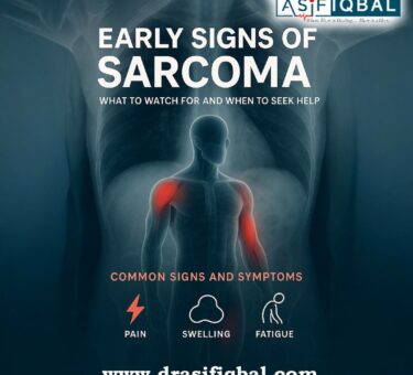Early Signs of Sarcoma: What to Watch For and When to Seek Help